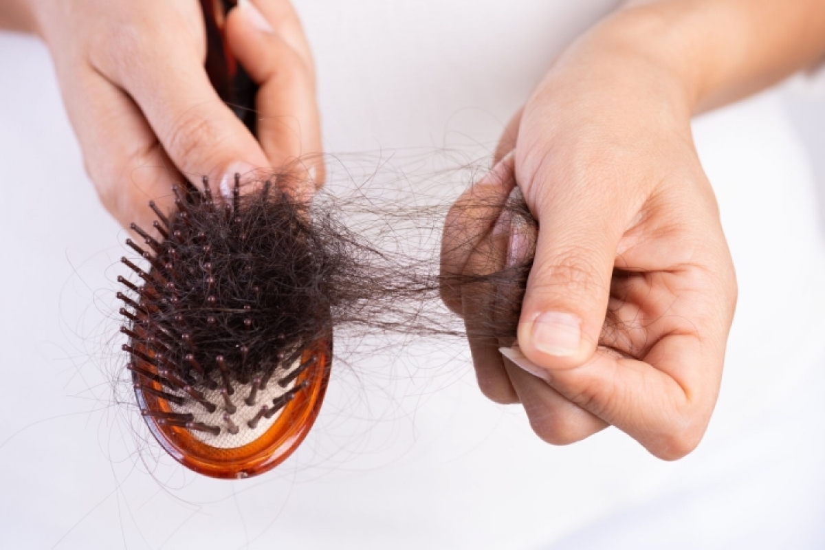 Mùa rụng tóc đã đến, chuyên gia chỉ cách đối phó cấp tốc